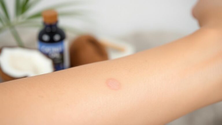 coconut oil treats ringworm